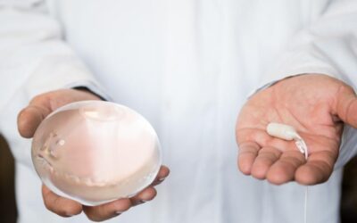 ¿Sin Cirugía Y Con Resultados? Conoce El Balón Gástrico Allurion